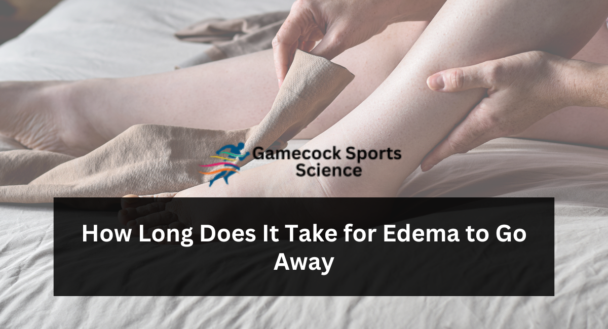 How Long Does It Take for Edema to Go Away